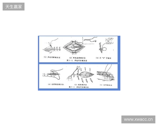 广州豹官方:杨浩眉弓伤口缝合30余针,预计5-7天后拆线 广州豹官方:杨浩眉弓伤口缝合30余针,预计5-7天后拆线